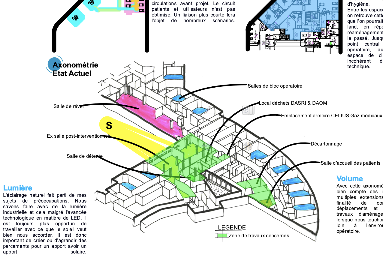 Axonométrie projet pré-opératoire IBOD/IAD – Jean-Baptiste Brulé – CHA Auxerre